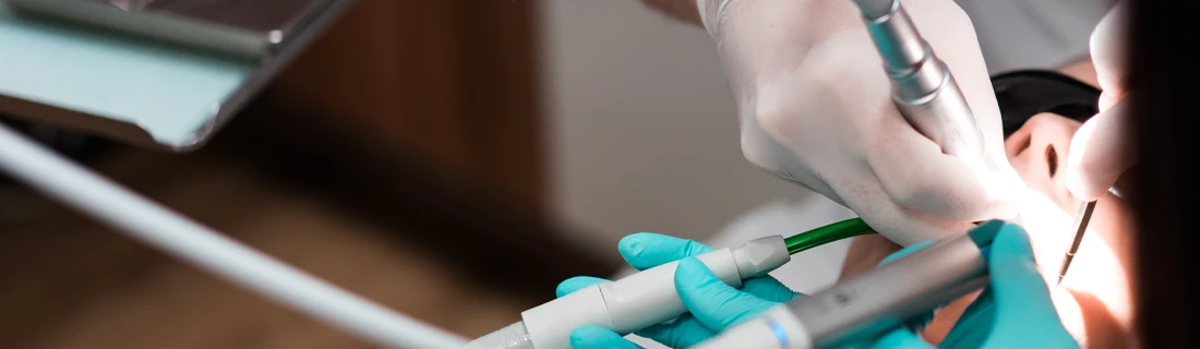 Close-Up Of A Dental Professional Performing A Dental Procedure
