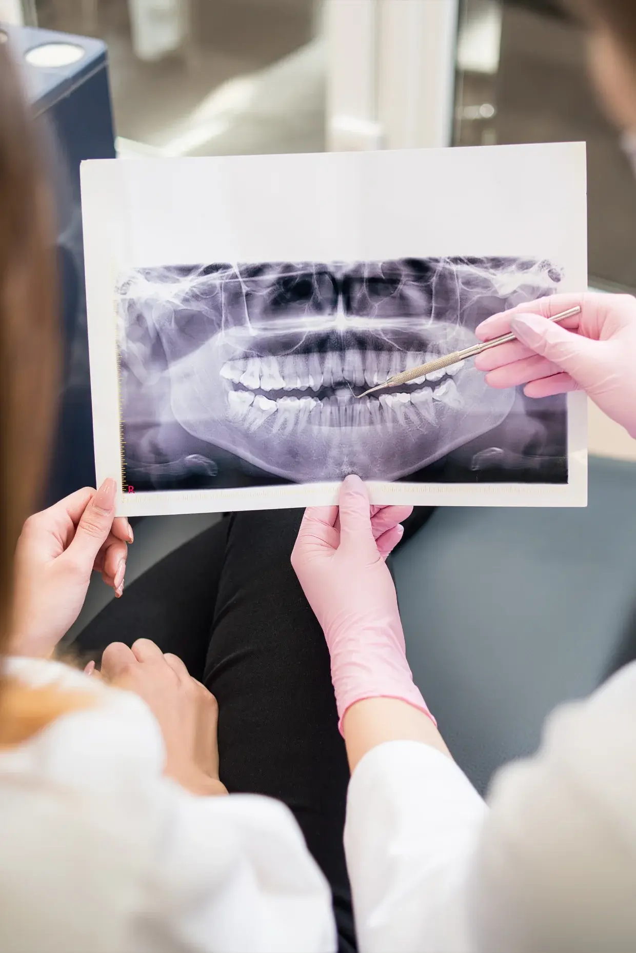 Dental Professionals Reviewing Panoramic Dental X-Ray